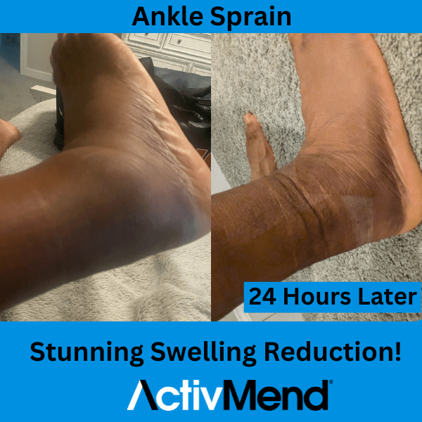 Swelling reduction in 24 hours