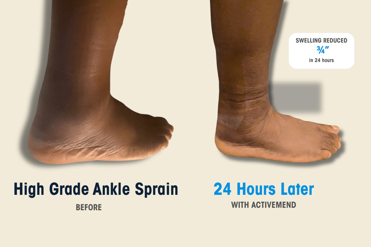 Movement is Key to Faster Healing - ActivMend