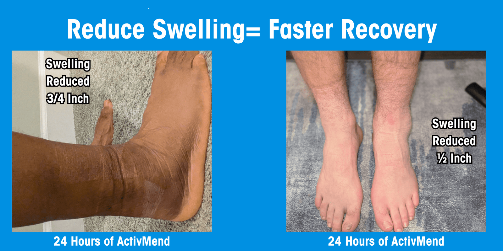 The Swelling on Day 4 Tells You Everything About Day 30 - ActivMend